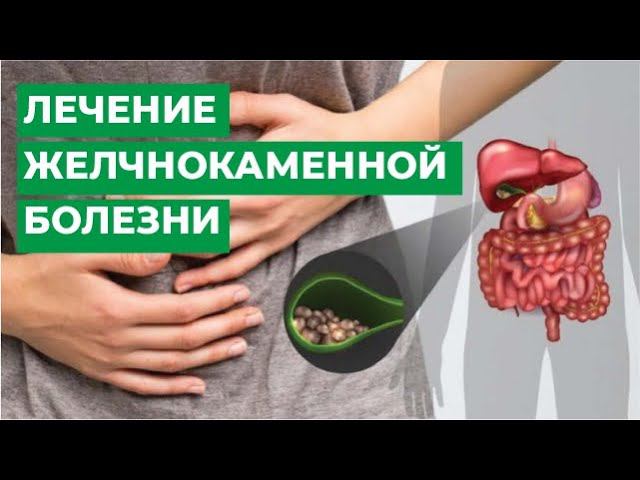 Желчнокаменная болезнь: лечение и питание, правильное меню и рекомендации